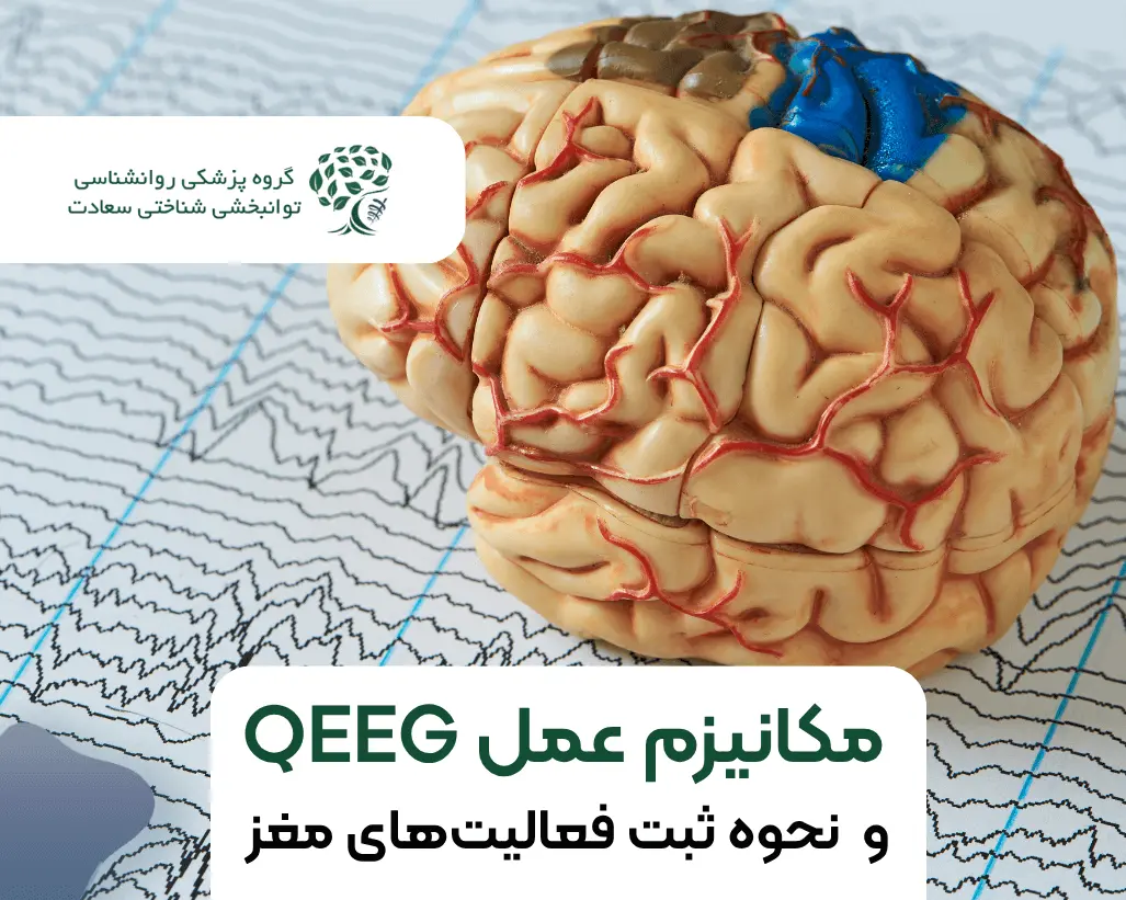 نحوه ثبت فعالیت‌های مغز